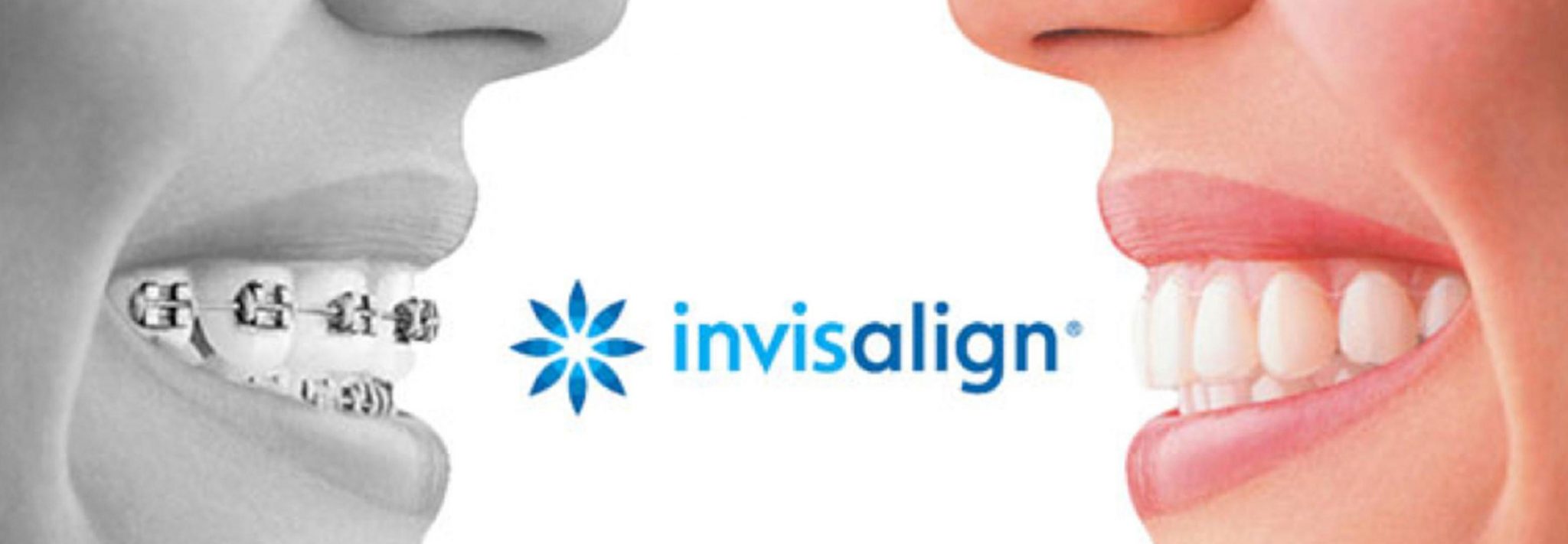 Invisalign Dentist, Dr. Awayes Delaware