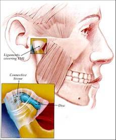 Craniofacial Disorders dentistry